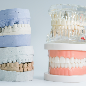 RPD ACRYLIC (+₹500/TOOTH)